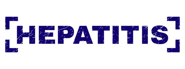 HEPATITIS text seal imprint with grunge texture. Text label is placed between corners. Blue vector rubber print of HEPATITIS with dust texture.