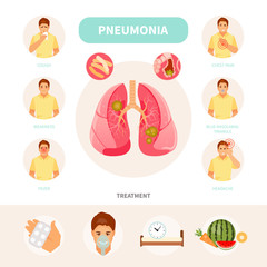 Pneumonia infographic vector