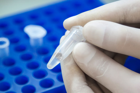 scientist hands in white gloves holding the eppendorf tube with DNA samples  in laboratory.