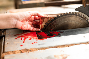 Hand and circular saw disc bloody on white background © Thicha