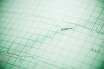 Electrocardiogram close up