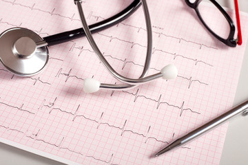 cardiology ekg graph