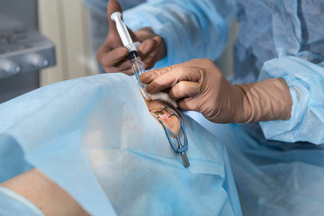 Laser surgery for vision correction