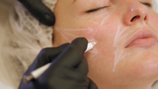 Close-up beautician draws the contours of a white pencil on the face of the patient. Schematic marking before contouring. Close-up preparation of the face for cosmetic plastic surgery.