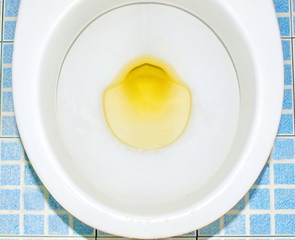 Urine or yellow pee in a bowl, wash the white bowl in the toilet bowl, sprinkle with urine.