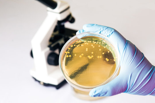 E.coli Escherichia bacteria in Petri dish in medical laboratory