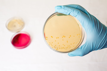 Petri dishes with growing bacteria in medical laboratory