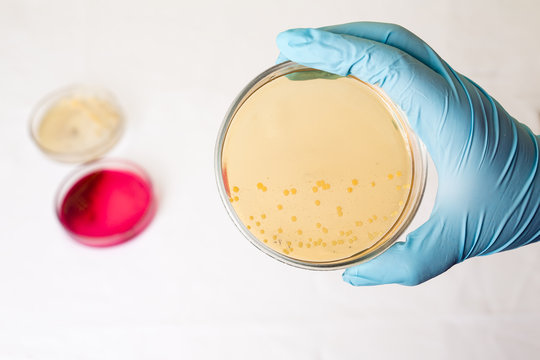 Petri dishes with growing bacteria in medical laboratory