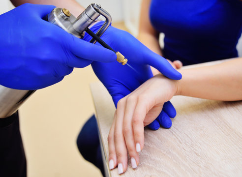 cryotherapy-cold treatment. A dermatologist examines a woman and holds a special device-a cryodestructor.effects on the human body by ultra-low temperatures