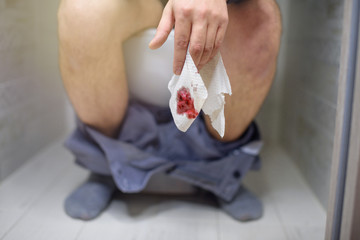 Man has stomach trouble, sitting on toilet bowl and has diarrhea or constipation or hemorrhoids. A...