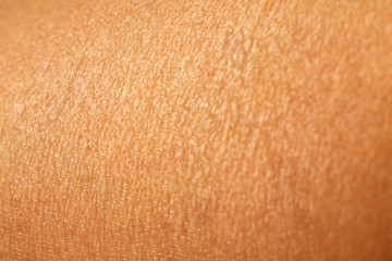 Woman's dry skin on leg, Close up & Macro shot, Asian Body skin part, Healthcare concept, Abstract background