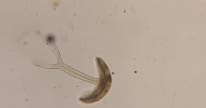 Study Movement and Specimens of Transversotrema patiallensis (parasite) under the microscopic in laboratory.
