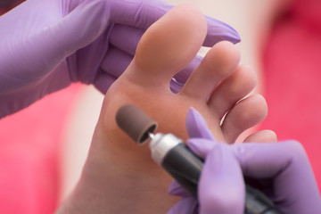 Foot skin treatment process. Gloved hands with a pedicure machine. Close-up