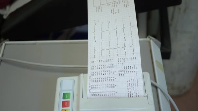 A cardiograph machine prints results of a recent cardiogram in a doctor's office.