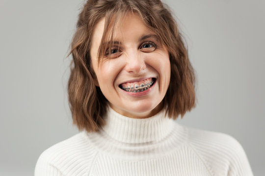 Young beautiful woman with braces