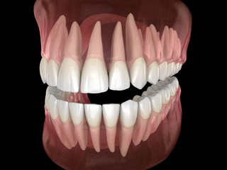 Morphology of mandibular and maxillary human gum and teeth. Medically accurate tooth 3D illustration