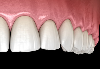 Maxillary human gum and teeth. Medically accurate tooth 3D illustration