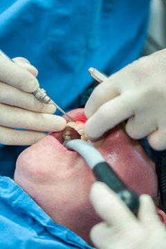 dentist at work