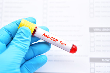Obraz premium Blood sample tube for anti-CCP test, diagnosis for rheumatoid arthritis disease