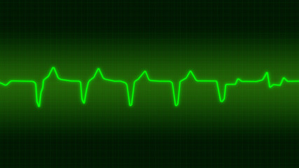 Electrocardiogramme