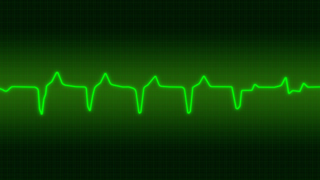 Electrocardiogramme