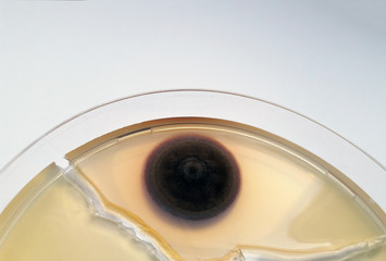 trichophyton rubrum in a petri dish grown on a nutrient environment