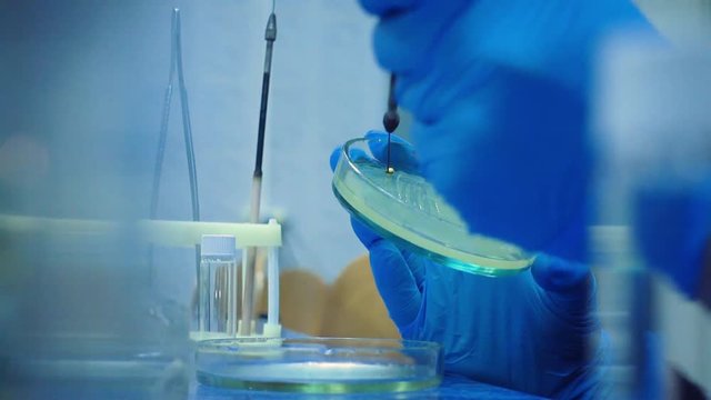 Collect bacteria from a Petri dish with a microbiological loop. Scientist collects bacteria from the nutrient medium.