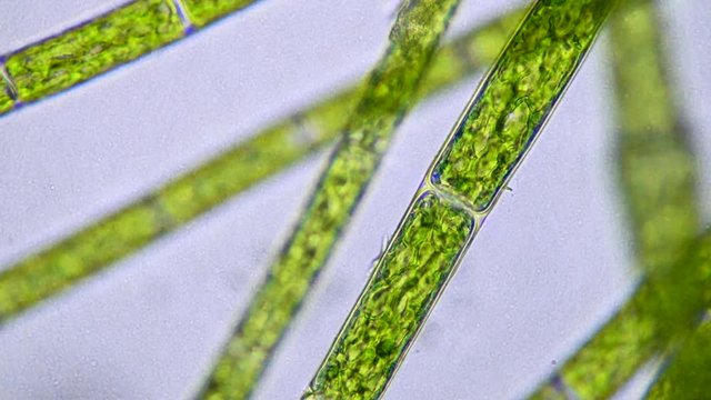 Filamentous Algae Phytoplankton under the microscope. Focusing on microscopic algae.