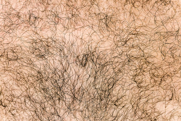 Body hair close-up. Hairy background. Fragment of human hair covering the pink skin.
