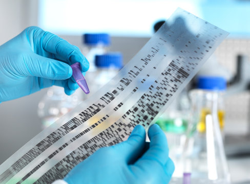 Scientist holding a DNA sample alongside the results on a autoradiogram in a laboratory