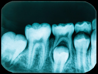 Old Dental x-ray