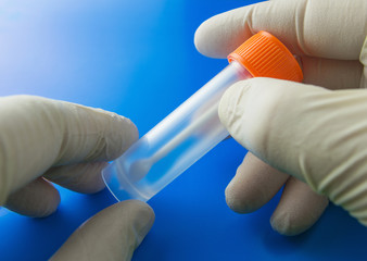 Doctor's hands with plastic container for analysis. Medical kit for the sampling of feces,...