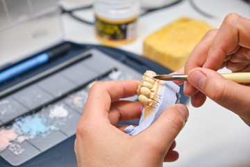 Technician dental is working with complete lower and upper metal ceramic prosthesis dental. Dental technician works by brush with jaw model