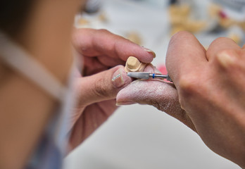 Dental technician using a brush with ceramic dental implants in his laboratory