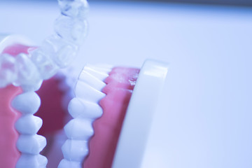 Invisible dental teeth aligners