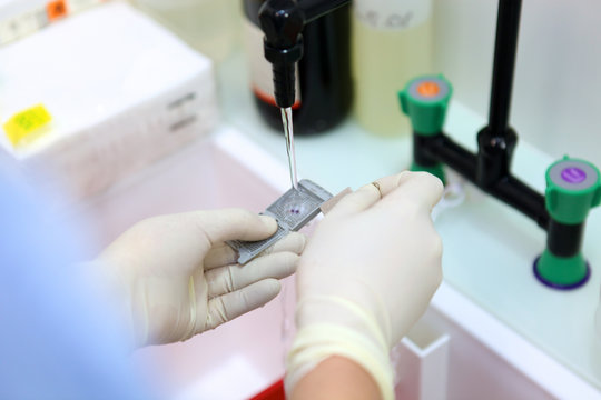 Lavage &eacute;chantillon dermatologie