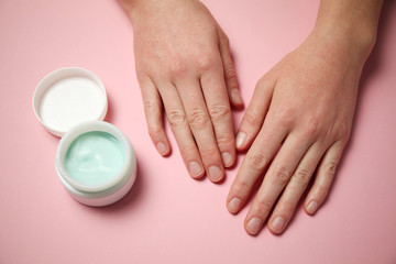 Female hands apply moisturizer to the skin. Irritation and allergies, frostbite.