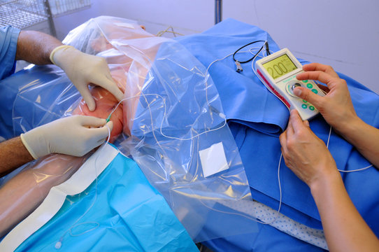 Catheter