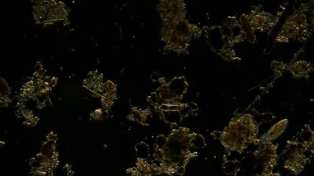 paramecium - ciliata under microscope – off-axis dark field illumination microscopy 4k microorganism