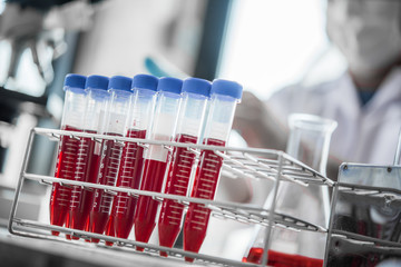 lab technician assistant analyzing a blood sample in test tube at laboratory. Medical, pharmaceutical and scientific research and development concept