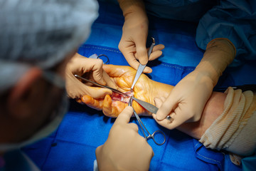 Surgeons performing hand surgery in hospital