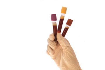 Nurse's hand with glove holding test tubes for blood tests isolated on white background