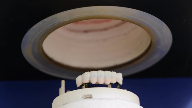 Ceramic dental crowns oven