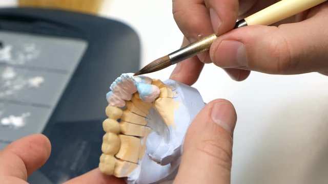 dental technician work. prosthesis production. teeth prototype construction
