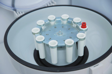 Collection of blood tests and their study, carrying out various tests with blood samples