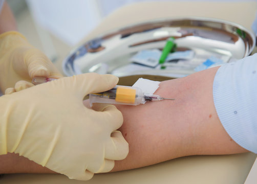 Collection of blood tests and their study, carrying out various tests with blood samples