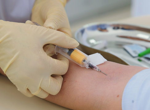 Collection of blood tests and their study, carrying out various tests with blood samples