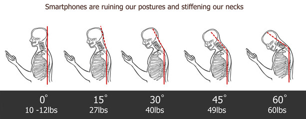 The bad smartphone postures,the angle of bending head related to the pressure on the spine, vector flat cartoon illustration. Man with phone with neck pain isolated on white background stock vector