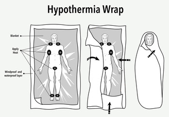 vector  illustration of a hypothermia wrap and  first aid