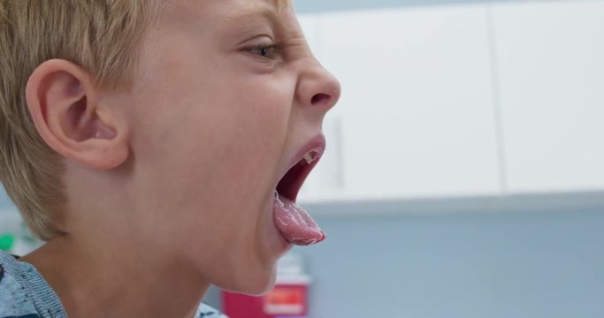 Close up of sick little boy with sore throat sticking out tongue. Pediatrician checking symptoms of child patient with fever. Slow motion 4k